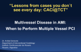 Multivessel Disease in AMI: When to Perform Multiple Vessel PCI