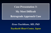Case Presentation 3: My Most Difficult Retrograde Approach Case in 2013