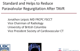 Annulus Sizing Using MSCT Is Now the Gold Standard and Helps to Reduce Paravalvular Regurgitation After TAVR