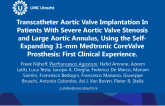 Transcatheter Aortic Valve Implantation In Patients With Severe Aortic Valve Stenosis and Large Aortic Annulus, Using the Self-Expanding 31-mm Medtronic CoreValve Prosthesis: First Clinical Experience