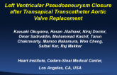 Second Prize: Case Presentation: Left Ventricular Pseudoaneurysm Closure after Transapical Transcatheter Aortic Valve Replacement