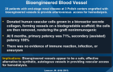 First-in-Man Evaluation of an Investigational Bioengineered Blood Vessel