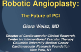 Robotic Angioplasty: The Future of PCI