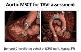 Aortic MSCT for TAVI Assessment
