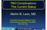 TAVI Complications: The Current Status