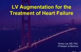 LV Augmentation for the Treatment of Heart Failure