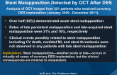 Incidences, Predictors, and Clinical Outcomes of Stent Malapposition Detected by OCT After DES