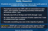 Outcomes of TEVAR in Acute, Complicated Type B Aortic Dissection