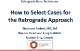 How to Select Cases for the Retrograde Approach