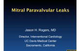 Mitral Paravalvular Leaks