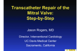 Transcatheter Repair of the Mitral Valve: Step-by-Step