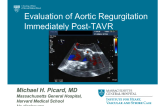 Evaluation of Aortic Regurgitation Immediately Post-TAVR