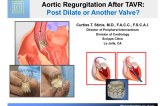 Aortic Regurgitation After TAVR: Post Dilate or Another Valve?