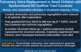 Feasibility, Short-term Outcomes of Transcatheter Pulmonary Valve Replacement in Small Children with Dysfunctional RV Outflow Tract Conduits