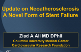 Update on Neoatherosclerosis: A Novel Form of Stent Failure