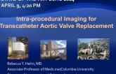 Intra-procedural Imaging for Transcatheter Aortic Valve Replacement
