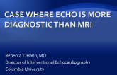 Case Where Echo is More Diagnostic Than MRI