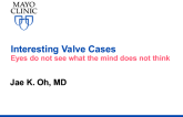 Interesting Valve Cases: Eyes do not see what the mind does not think