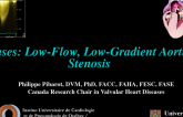 Cases: Low-Flow, Low-Gradient Aortic Stenosis