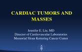 Cardiac Tumors and Masses