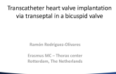 Transcatheter Heart Valve Implantation via Transeptal in a Bicuspid Valve