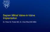 Sapien Mitral Valve-in-Valve Implantation