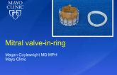 Transcatheter Mitral Valve-in-Ring