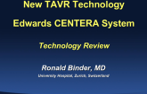 CENTERA- Technology Review, Clinical Results, and Case Examples