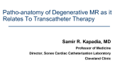 The Pathoanatomy of Degenerative MR as it Relates to Transcatheter Therapy