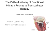 The Pathoanatomy of Functional MR as it Relates to Transcatheter Therapy