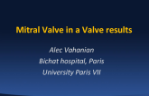 Mitral Valve-in-Valve Results