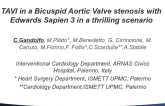 TAVI in A Bicuspid Aortic Valve Stenosis With Edwards Sapien 3 In A Thrilling Scenario