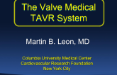 The Valve Medical TAVR System