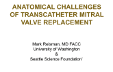 Anatomical Challenges of TMVR