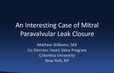 An Interesting Case of Mitral Paravalvular Leak Closure