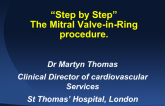 Mitral Valve-in-Ring