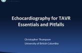 Echocardiography Essentials and Pitfalls  What EVERYONE MUST KNOW!