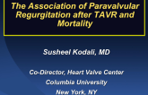 The Association of Paravalvular Regurgitation After TAVR and Subsequent Mortality: Comprehensive Review of the Literature and Observations from PARTNER