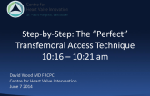 Step-by-Step: The Perfect Transfemoral Access Technique