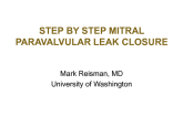 Step-by-Step  Techniques and Technology for Mitral Paravalvular Leak Closure (with Case Examples)