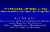 Perspectives on Predilation from an Experienced SAPIEN User