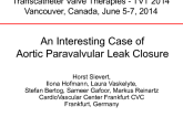 An Interesting Case of Aortic Paravalvular Leak Closure