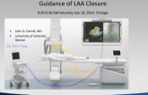 Use of Integrated 3D TEE-Fluoroscopy for Guidance of LAA Closure