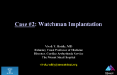 Case 2: Watchman Implantation