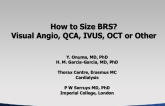 How to Size BRS? Visual Angio, QCA, IVUS, OCT or Other