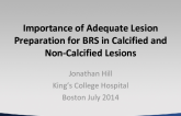 Importance of Adequate Lesion Preparation for BRS in Calcified and Non-Calcified Lesions