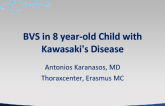 BVS in 8 year-old Child with Kawasaki's Disease