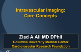 Intravascular Imaging: Core Concepts