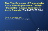 PARTNER I: Five-Year Results From a Prospective, Randomized Trial of Transcatheter Aortic Valve Replacement with a Balloon-Expandable Device Versus Conservative Care in Extremely High-Risk Patients with Aortic Stenosis