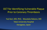 OCT for Identifying Vulnerable Plaque Prior to Coronary Thrombosis